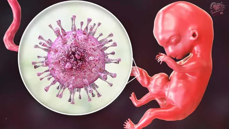 Nhiễm Cytomegalovirus là bệnh gì? Xử lý ra sao?