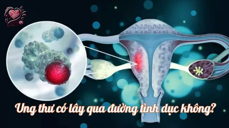 Ung thư có lây qua đường tình dục không? Các biện pháp phòng tránh