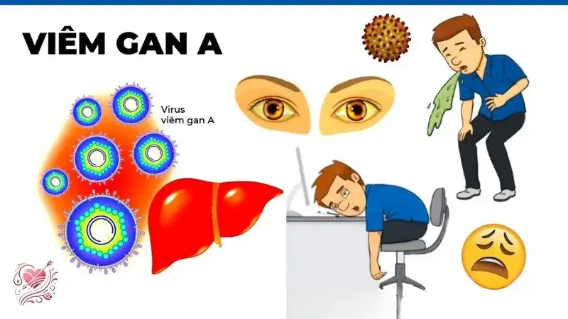Viêm gan A là gì? Dấu hiệu nhận biết và phương pháp điều trị