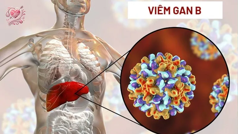 Viêm gan B có nguy hiểm không? Những điều bạn cần biết