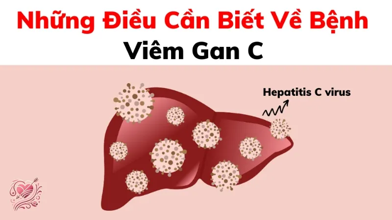 Viêm gan C lây qua đường nào? Cách phòng tránh hiệu quả
