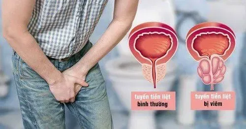 Nguyên nhân gây xuất tinh xong bị đau