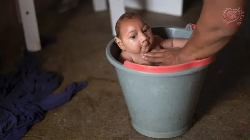 Zika virus là bệnh gì? Nguyên nhân gây bệnh