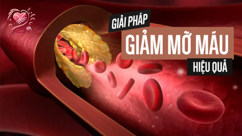 Thực phẩm chức năng giảm mỡ máu tốt nhất hiệu quả nhất cho sức khỏe