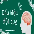 Dấu hiệu đột quỵ dễ nhận ra nhưng 99% người việt bỏ qua