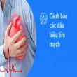 Dấu hiệu tim mạch nguy hiểm bạn tuyệt đối không bỏ qua