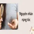 Nguyên nhân rụng tóc và thói quen hại da đầu mỗi ngày
