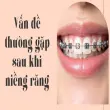 Vấn đề thường gặp sau khi niềng răng theo từng giai đoạn