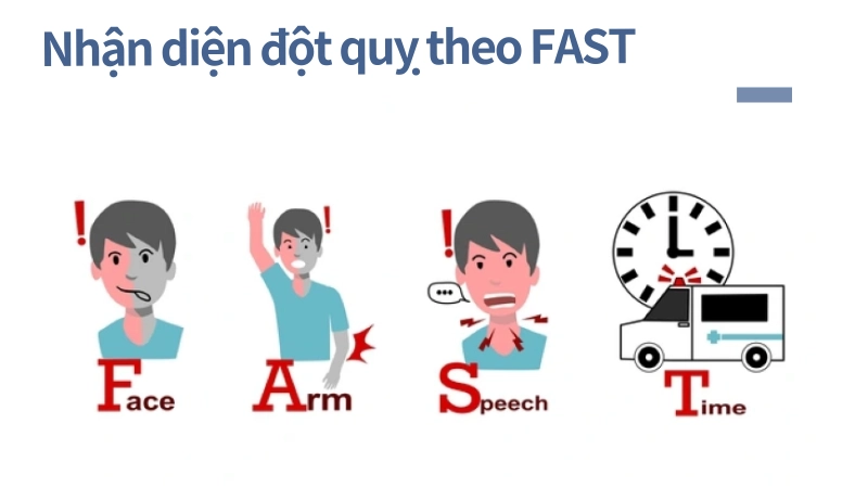 Quy tắc FAST nhận diện đột quỵ ngay lập tức
