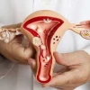 Giai đoạn hoàng thể là gì? Vai trò và ý nghĩa với kết quả mang thai