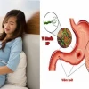 Giảm Đau Dạ Dày Khi Mang Thai An Toàn Cho Mẹ Bầu