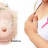 Quầng vú là gì? Cấu tạo, chức năng và các vấn đề sức khỏe liên quan