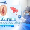 Vá màng trinh quan hệ có ra máu không? Phân tích chi tiết