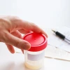 Xét nghiệm tinh dịch đồ giá bao nhiêu tiền và quy trình thực hiện?