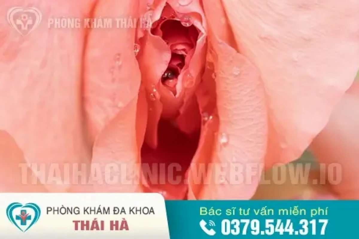 Quan hệ nhiều có bị rộng không? Nguyên nhân và cách khắc phục