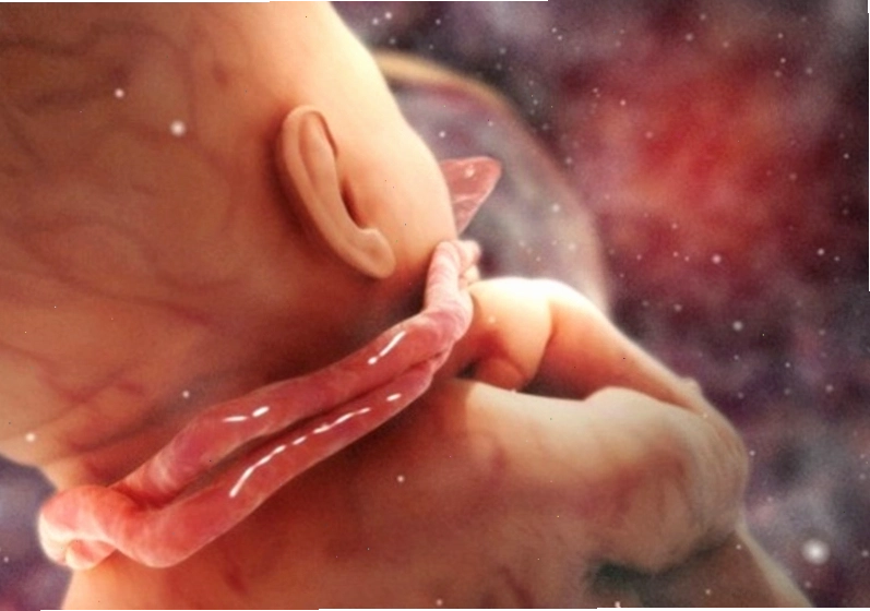 Bất thường dây rốn có thể là nguyên nhân trực tiếp dẫn đến thai lưu nếu không được can thiệp kịp thời