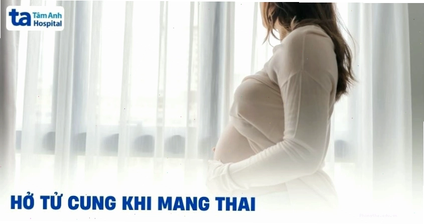 Bị hở tử cung khi mang thai có sao không?