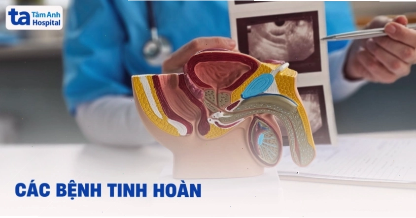 Các bệnh tinh hoàn thường gặp ở nam giới phổ biến hiện nay