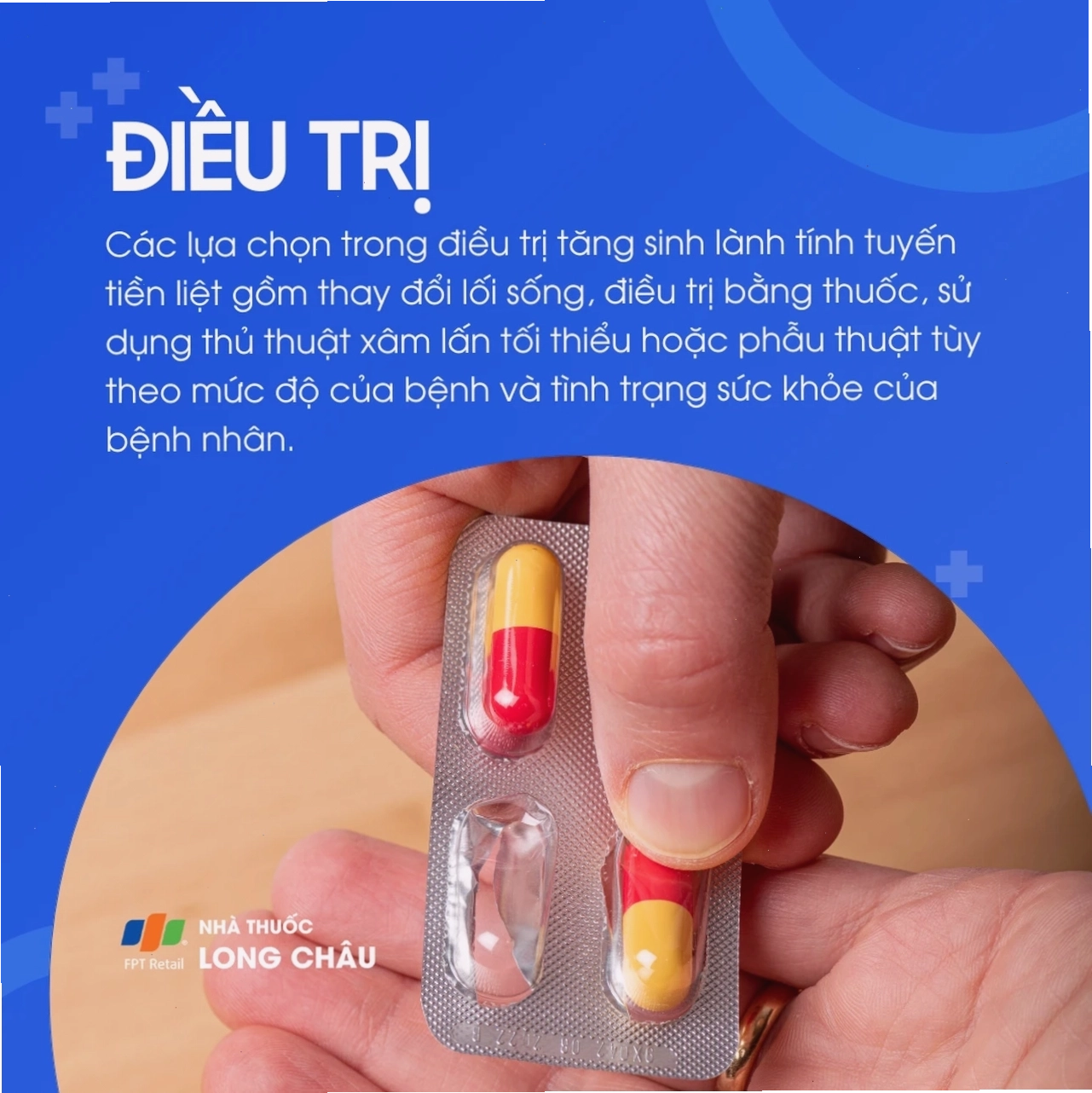 Các biện pháp phòng ngừa phì đại tuyến tiền liệt