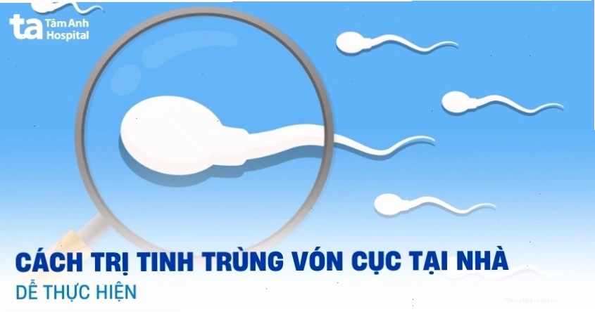 Các bước khắc phục tinh trùng vón cục tại nhà và khi nào cần đi khám bác sĩ