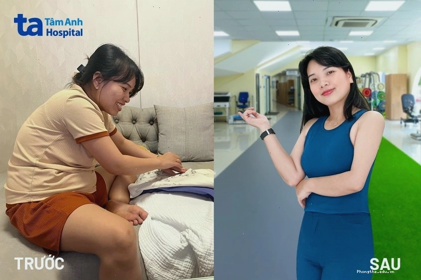 Chị Thảo trước và sau khi áp dụng chế độ giảm cân khoa học