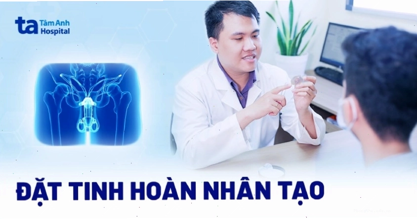 Đặt tinh hoàn nhân tạo là một lựa chọn sau phẫu thuật cắt bỏ tinh hoàn