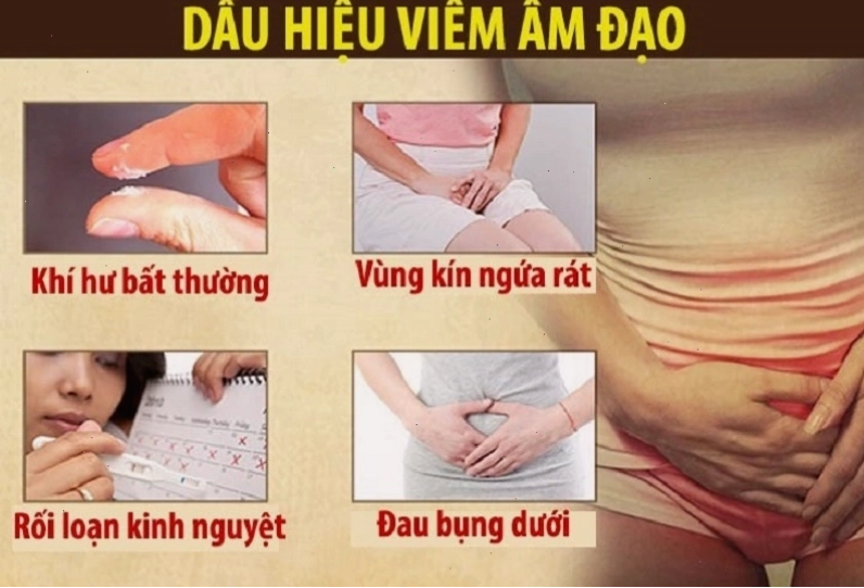 Dấu hiệu cảnh báo nữ giới bị viêm âm đạo cần chú ý thăm khám