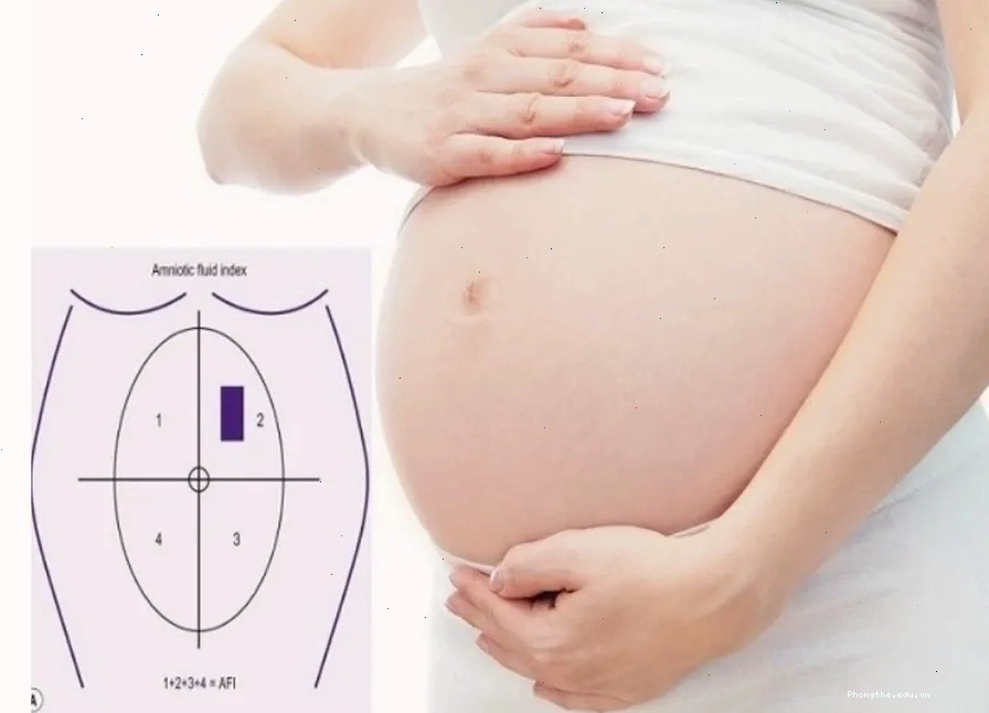 Đo lường xoang ối lớn nhất để đánh giá lượng nước ối