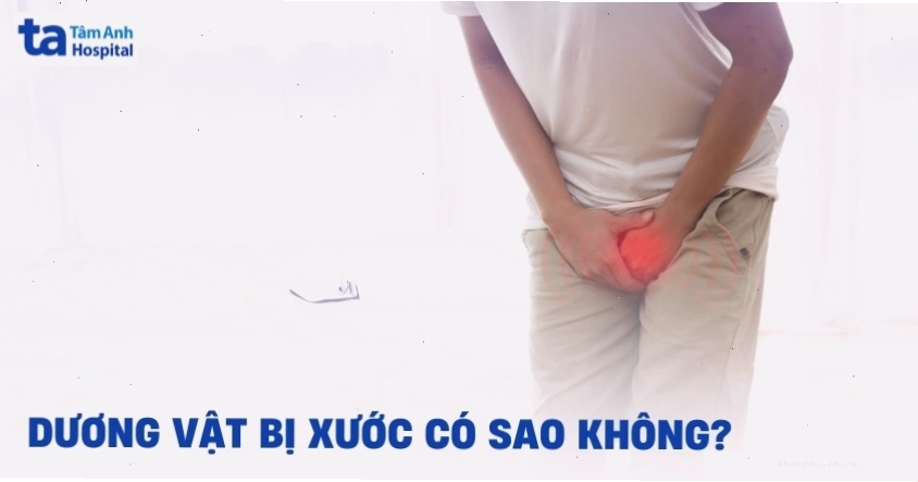 Dương vật bị xước phải làm sao