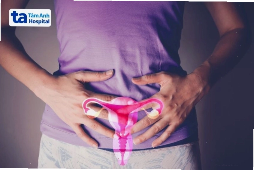 Giai đoạn hoàng thể kéo dài có thể là dấu hiệu của buồng trứng đa nang