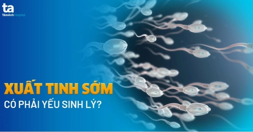 Hiểu rõ nguyên nhân giúp điều trị xuất tinh sớm hiệu quả hơn