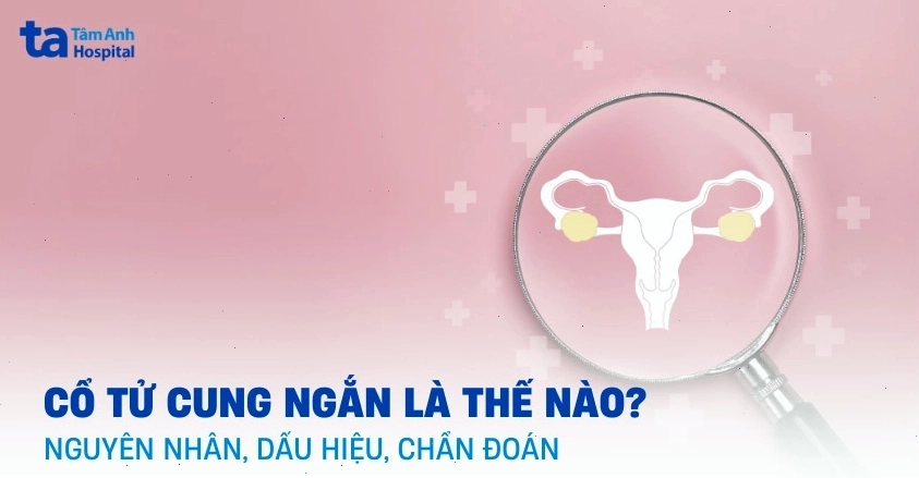 Hình ảnh minh họa cổ tử cung ngắn