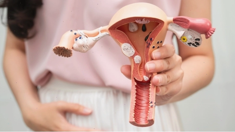 Hình ảnh minh họa tử cung to bất thường so với kích thước sinh lý