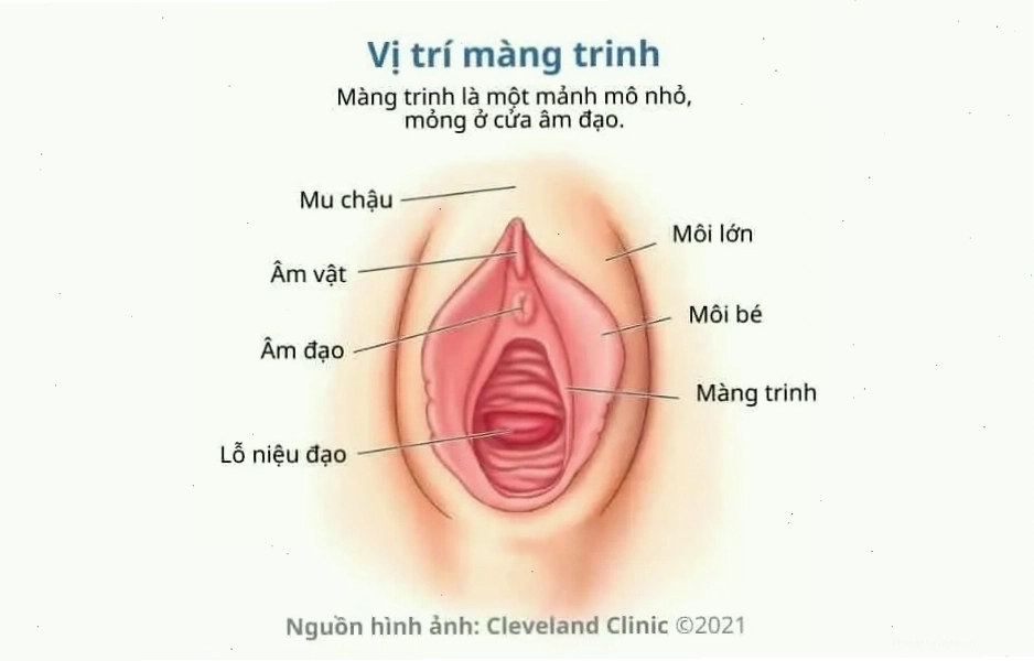 Hình ảnh nhận biết màng trinh còn hay rách qua thăm khám chuyên môn