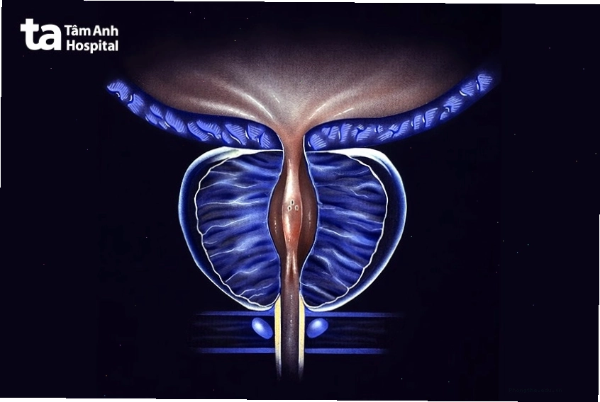 Kích thước tuyến tiền liệt tăng dần theo tuổi tác