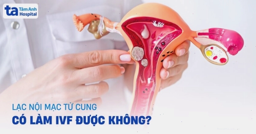 Lạc nội mạc tử cung và khả năng thụ tinh trong ống nghiệm
