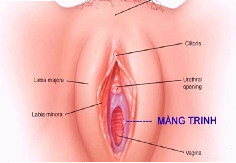 Màng trinh rất mỏng và rất dễ rách do nhiều tác nhân
