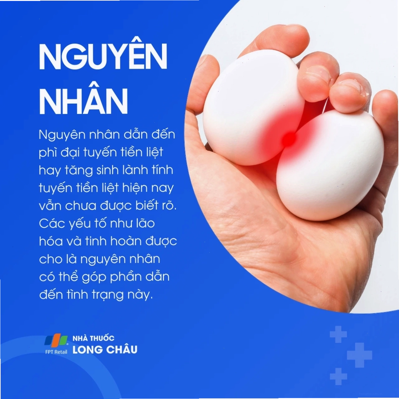 Minh họa các loại thuốc điều trị phì đại tuyến tiền liệt