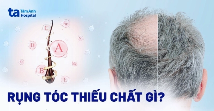 Minh họa các thực phẩm giàu dinh dưỡng tốt cho tóc
