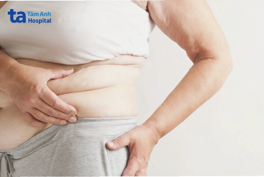 Mỡ bụng sau sinh cần thời gian phục hồi và áp dụng phương pháp giảm cân phù hợp