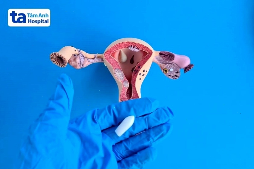 Nên thực hiện đặt thuốc sau chuyển phôi đúng cách theo hướng dẫn từ bác sĩ