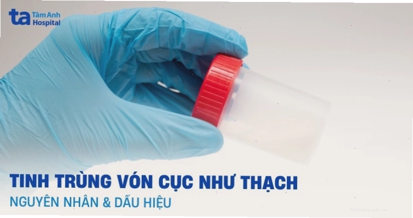 Nguyên nhân tinh trùng vón cục như thạch do viêm nhiễm hoặc rối loạn chức năng túi tinh
