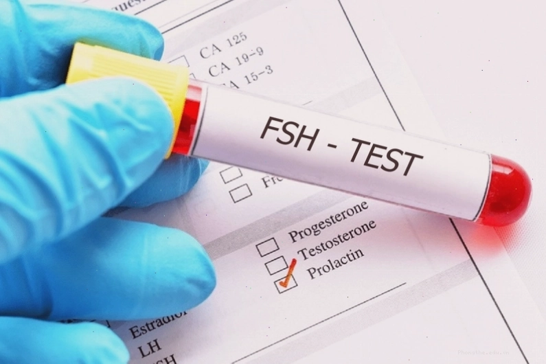 Những thông tin cần biết về xét nghiệm FSH