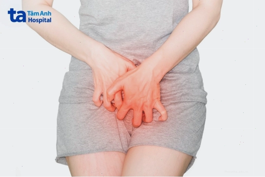 Nổi hạch ở bẹn đi kèm triệu chứng ngứa viêm đỏ da