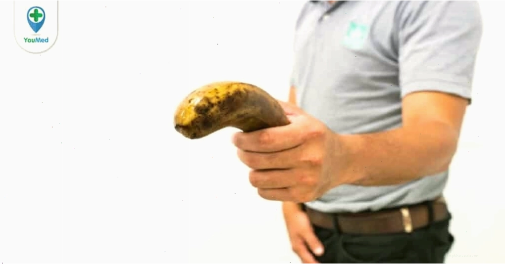 Nổi nốt đỏ ở bao quy đầu