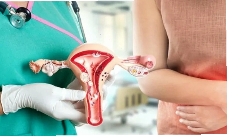 Nong cổ tử cung là một trong những phương pháp xử lý bế sản dịch