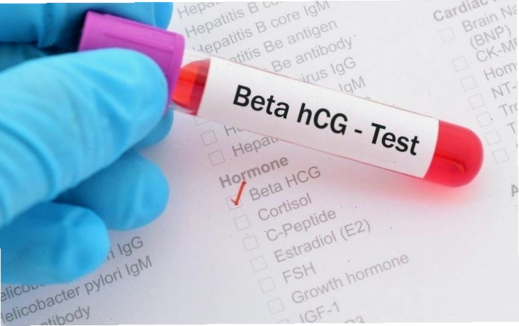 Nồng độ β-hC có liên quan đến thắc mắc quan hệ 10 ngày đã biết có thai chưa