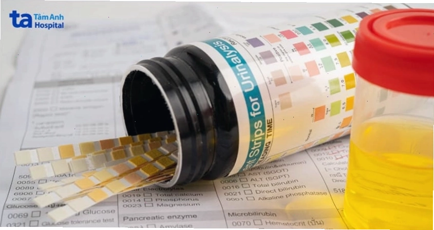 Phân tích nước tiểu là một trong những xét nghiệm quan trọng để chẩn đoán