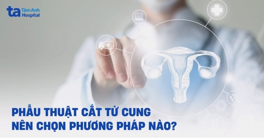 Phẫu thuật cắt tử cung