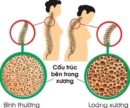 Phụ nữ trung niên đang trải qua cơn bốc hỏa